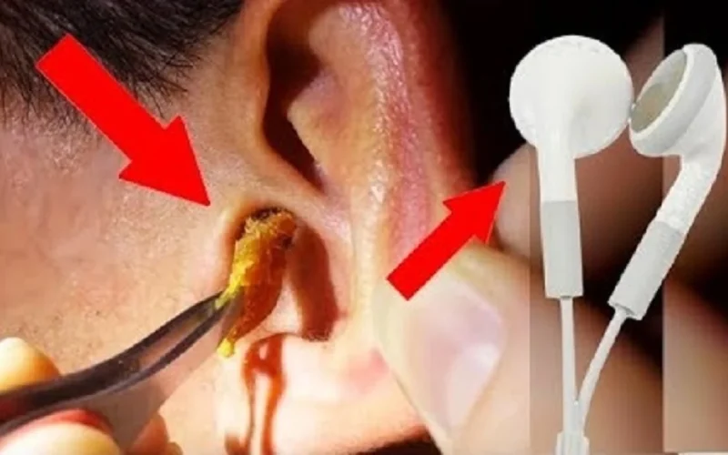 في أقل من دقيقة.. طريقة إخراج الشمع من الأذن بدون ألم أو مجهود